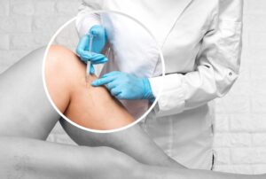 tipos de escleroterapia