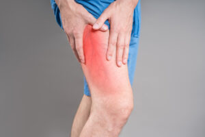 perna com sintomas de insuficiência venosa