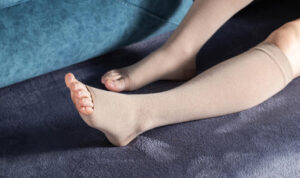 pernas com meias compressoras